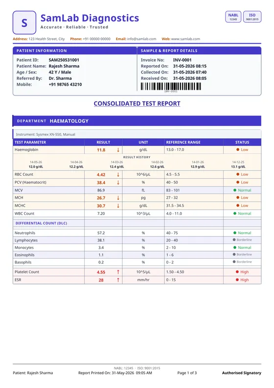 Report in indigo